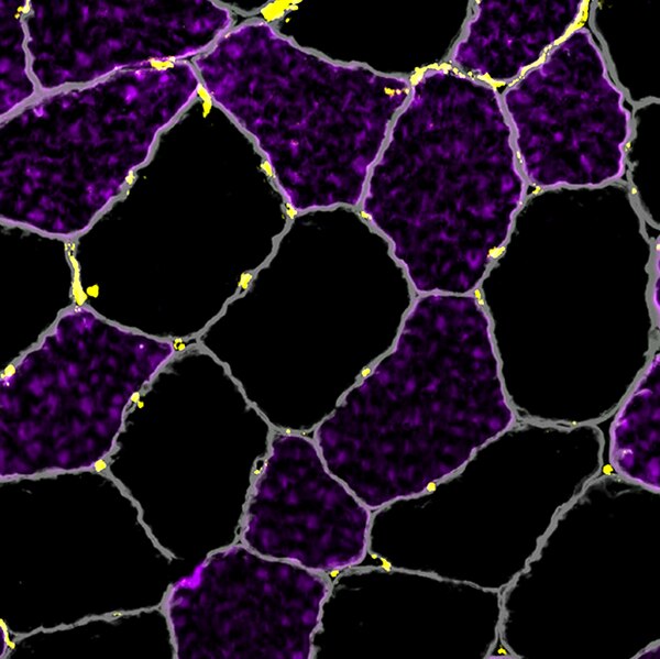 Immunofluorescent image of a human vastus lateralis muscle biopsy labeled with DSHB antibody P2B1 against PECAM1/CD31 (yellow) and DSHB antibody BA-D5 (purple). PMID: 4047868, Fig. 4C.
